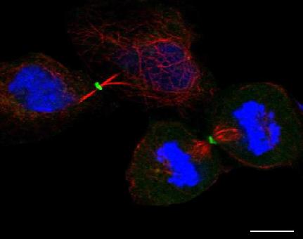 Mouse Anti-TP63 (Dako Omnis) Recombinant Antibody 