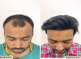 Best Skin and Hair Treatm..