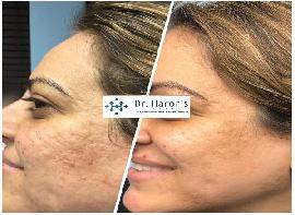 Best Skin Treatments clin..