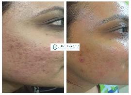 Skin Treatment in Rajouri..