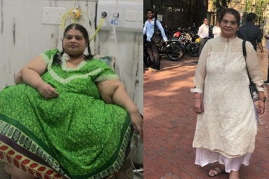 Asia’s Heaviest Woman Amita Rajani Shed 214 Kgs in Four Years Now Weighing Around 80 Kgs