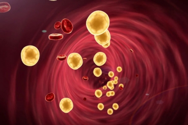 What Parents have to know about Cholesterol In Children?