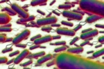 E.coli Outbreak deaths, E.coli Outbreak, all about e coli outbreak in the united kingdom, Scotland