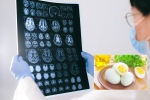 Eggs and Alzheimer’s for health, Eggs and Alzheimer’s tips, eggs may help prevent alzheimer s study, Peanuts Eggs and Alzheimer’s for health, Eggs and Alzheimer’s tips, eggs may help prevent alzheimer s study, Peanuts