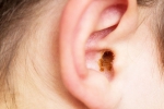 Ear Wax treatment, Ear Wax, how to remove ear wax, Ear wax
